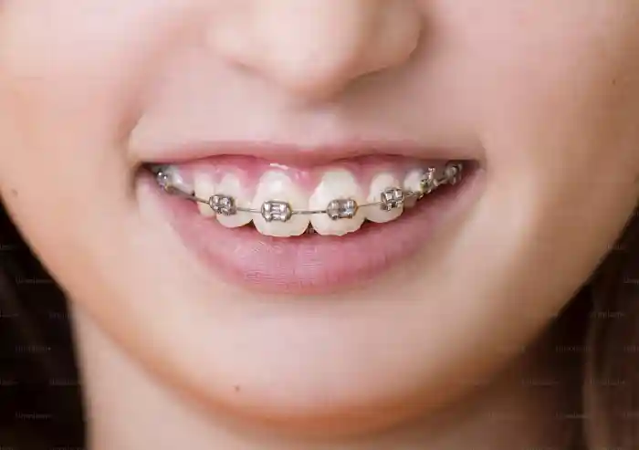 Orthodontics Background